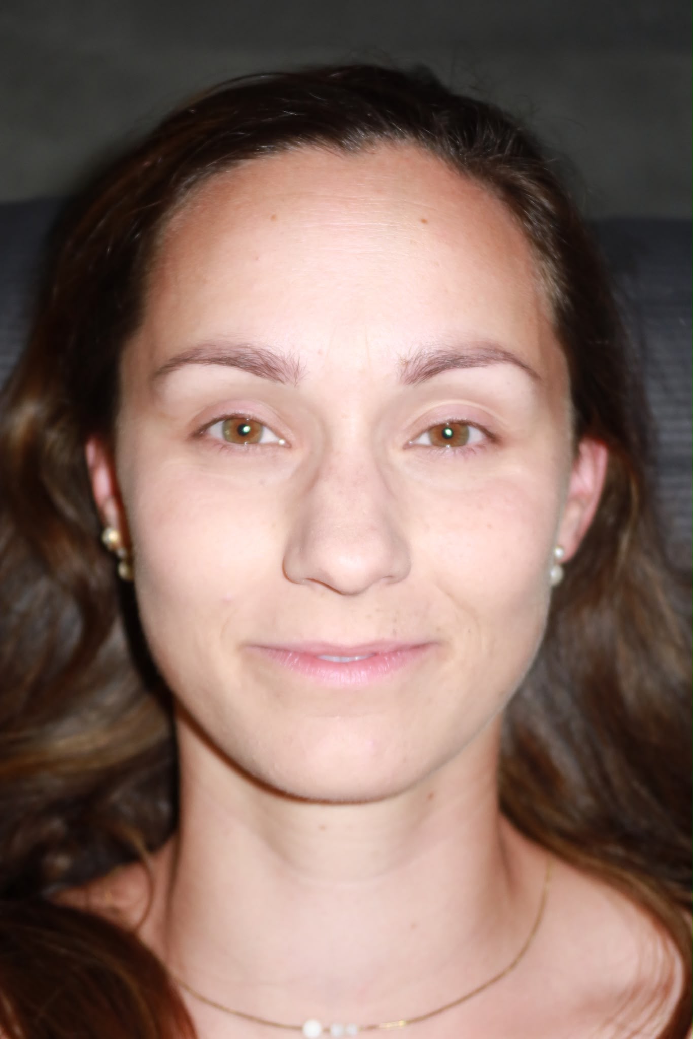 Wimpern vor der Behandlung